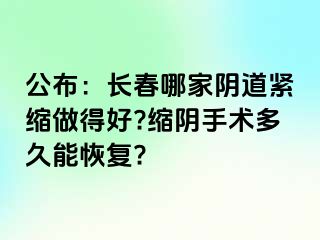 公布：长春哪家阴道紧缩做得好?缩阴手术多久能恢复?