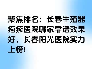 聚焦排名：长春生殖器疱疹医院哪家靠谱效果好，长春阳光医院实力上榜!