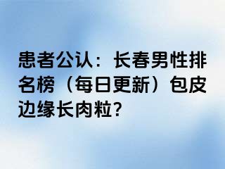 患者公认：长春男性排名榜（每日更新）包皮边缘长肉粒？