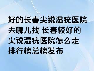 好的长春尖锐湿疣医院去哪儿找 长春较好的尖锐湿疣医院怎么走 排行榜总榜发布