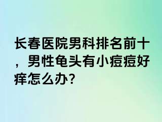 长春医院男科排名前十，男性龟头有小痘痘好痒怎么办？