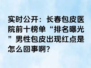 实时公开：长春包皮医院前十榜单“排名曝光”男性包皮出现红点是怎么回事啊？