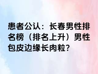 患者公认：长春男性排名榜（排名上升）男性包皮边缘长肉粒？