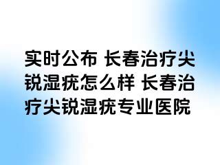 实时公布 长春治疗尖锐湿疣怎么样 长春治疗尖锐湿疣专业医院