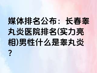 媒体排名公布：长春睾丸炎医院排名(实力亮相)男性什么是睾丸炎？